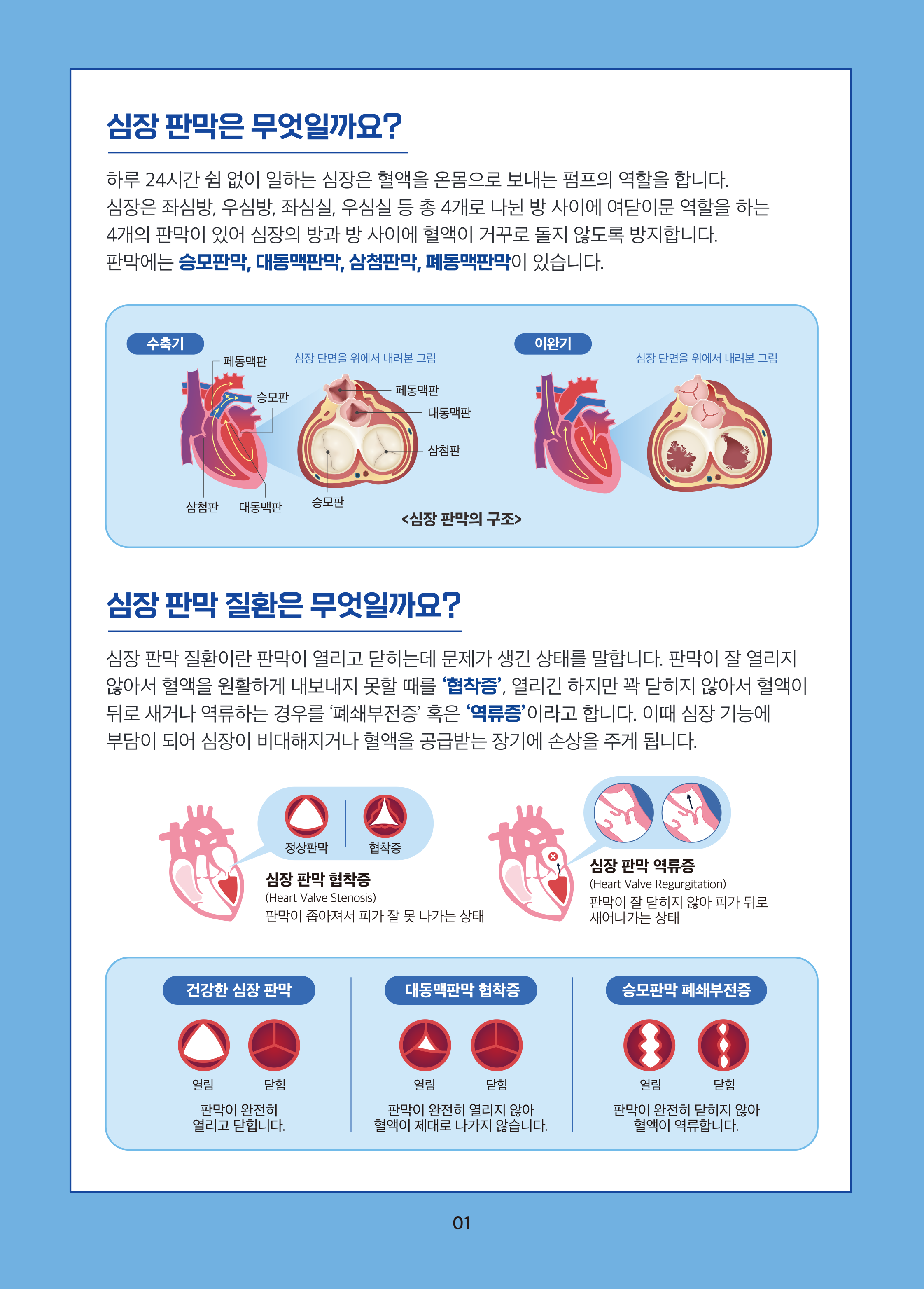 하트시그널 2페이지 - 심장 판막 질환 안내